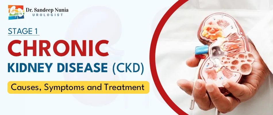 Stage 1 of chronic kidney disease CKD: Causes, symptoms and treatment