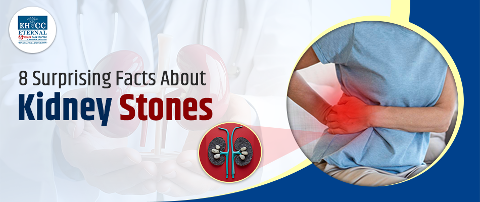 8 Surprising Facts About Kidney Stones