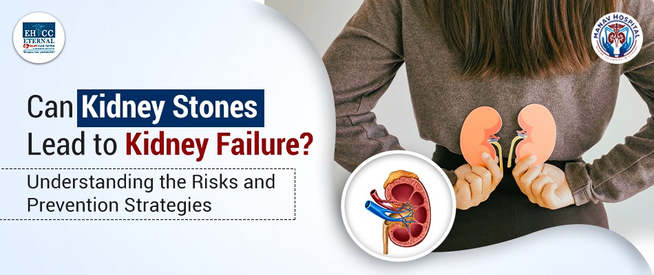 Can Kidney Stones Lead to Kidney Failure: Understanding the Risks and Prevention Strategies