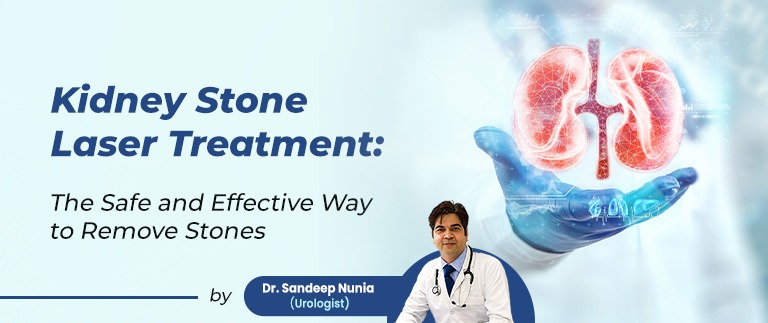 Kidney Stone Laser Treatment: The Safe and Effective Way to Remove Stones
