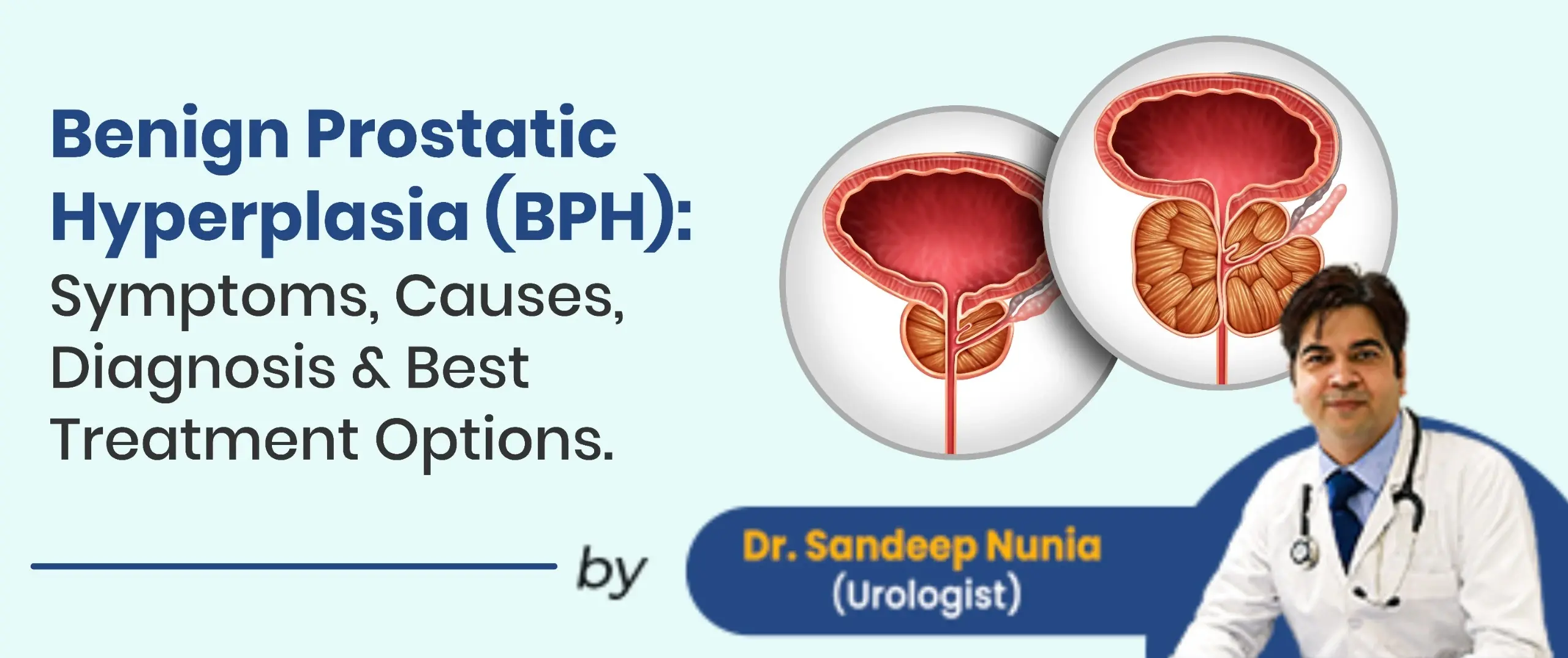 Struggling With Urinary Problems? A Complete Guide to Benign Prostatic Hyperplasia