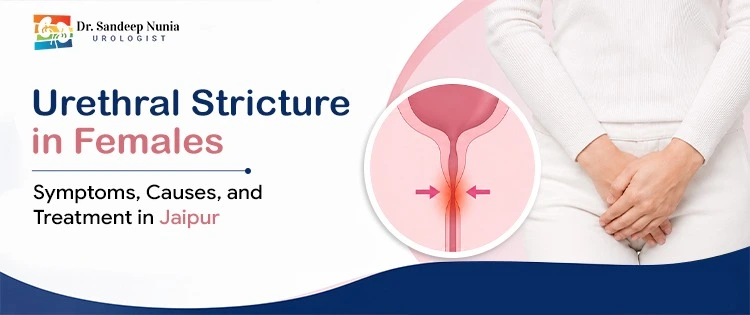 Urethral Stricture in Females: Symptoms, Causes, and Treatment in Jaipur